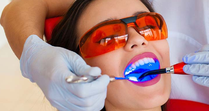 GIẢM 50% DỊCH VỤ TẨY TRẮNG RĂNG